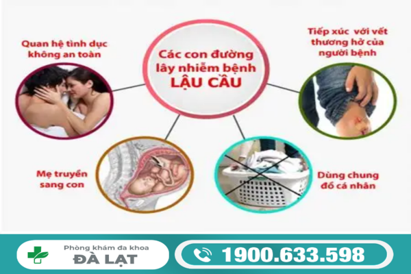 Hình ảnh minh họa